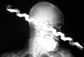 7 Fatal Injuries That People Survived